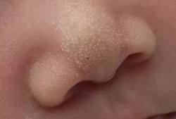 怀孕初期吃小白瓜,营养美味，助力宝宝健康成长