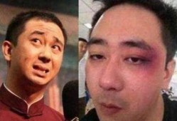 家暴男演员吃瓜,揭秘男演员家暴事件背后的真相与反思